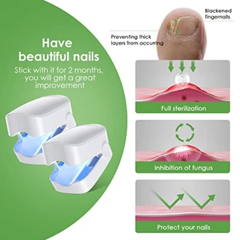 Мини-лазерное устройство для удаления грибка ногтей, поврежденных, обесцвеченных толстых ногтей на ногах, Эффективное перезаряжаемое средство для удаления грибка ногтей